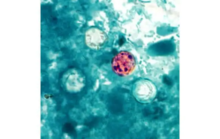 DOH reports two new travel-related cyclosporiasis cases in Hawaii